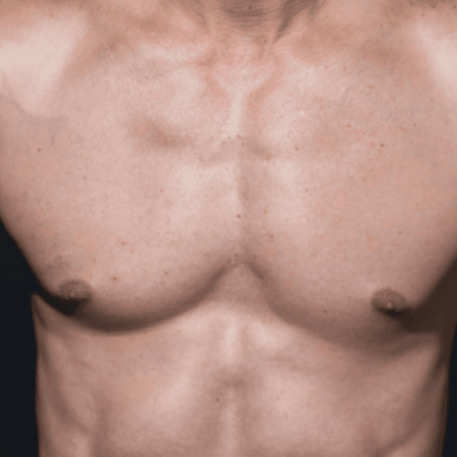 Upper Body Reset (3) at Mne Aesthetics in Missouri City, TX